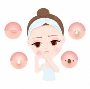 南京皮肤研究所看痘痘哪个医生好?全面解读助你战“痘”到底