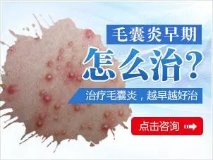 头上长疙瘩痒怎么治疗