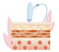 南京哪家医院做激光皮秒去色素好